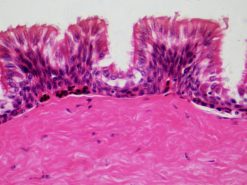 Bresser Bresser Lames Preparees : Histologie | Preparations