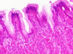 Bresser Bresser Lames Preparees : Histologie | Preparations